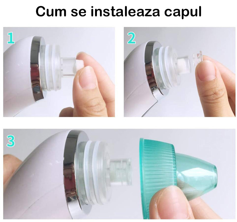 Aparat electric pentru scos puncte negre, Horigen B Pro 8 Aparat electric pentru scos puncte negre, Horigen B Pro 8